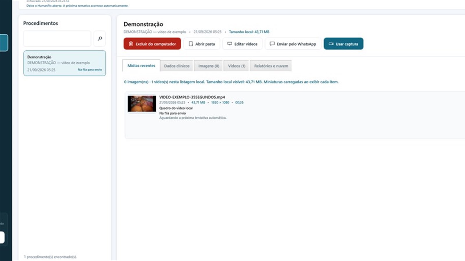 Biblioteca do HumanPix Software com o procedimento aberto, os bot&otilde;es de edi&ccedil;&atilde;o e a lista de v&iacute;deos e imagens do procedimento