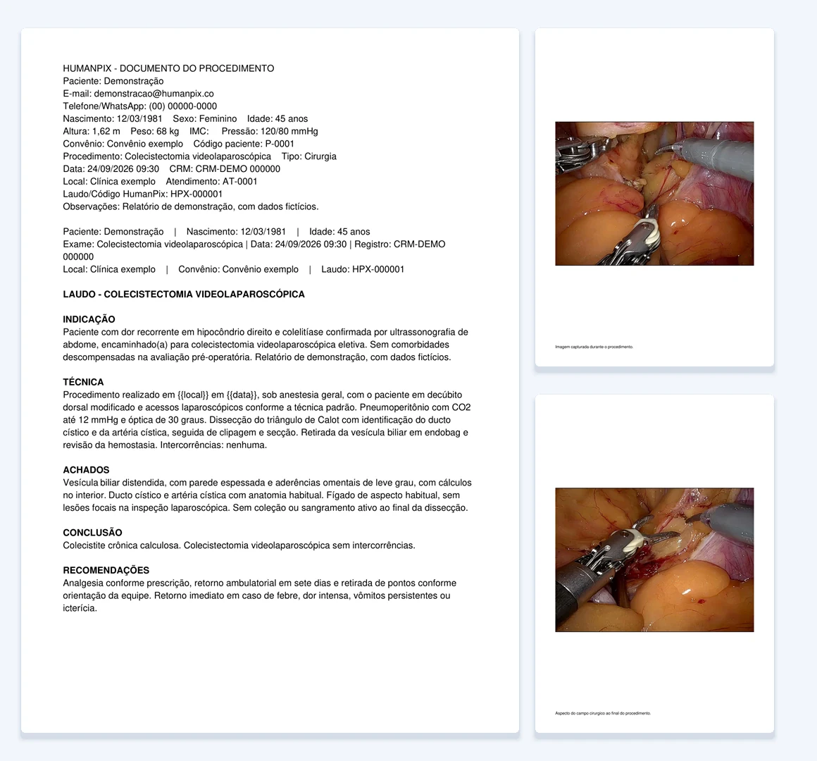 Laudo do HumanPix em PDF com o texto do exame e as imagens capturadas no procedimento